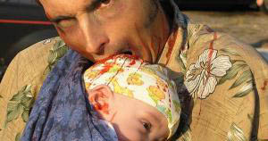 Long-term survivor
